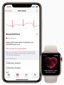 Apple Watch's ECG System Comes to Europe, Hong Kong