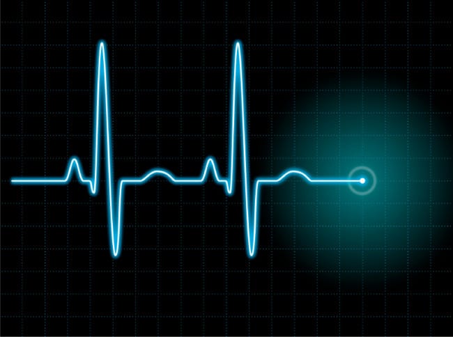 Huami and AliveCor Team Up to Develop Better ECG Technology